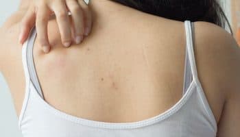 Woman scratching her back with her left hand