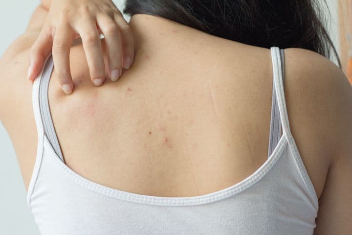 Woman scratching her back with her left hand