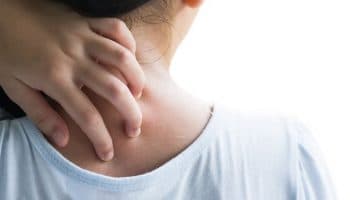 Woman scratching the back of her neck