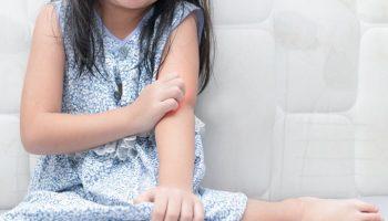 Girl scratching her left elbow while sitting with her legs folded to the side