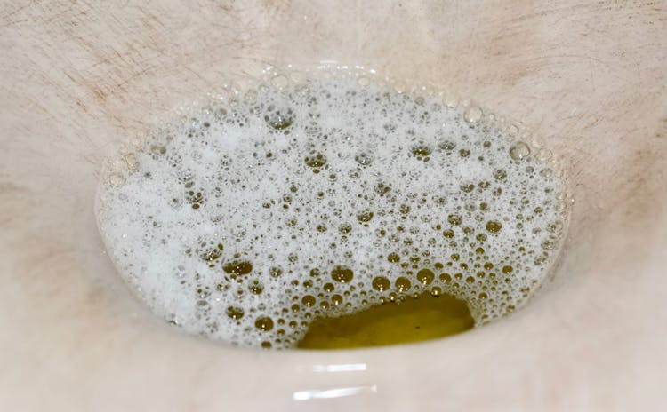bubbles in urine