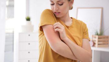 A young blonde woman scratching an eczema rash on her hand