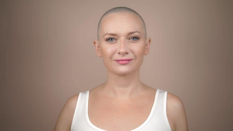 Alopecia min scaled