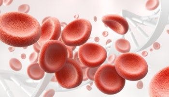 Iron deficiency anemia discover its symptoms and supplements to take